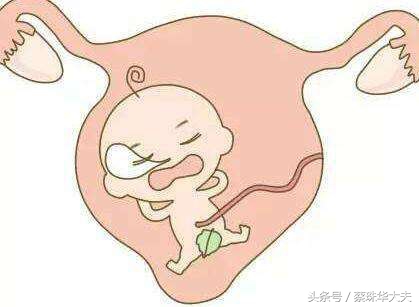 13周胎盘下缘达宫颈内口腹痛,怀孕13周胎盘覆盖宫颈内口严重吗