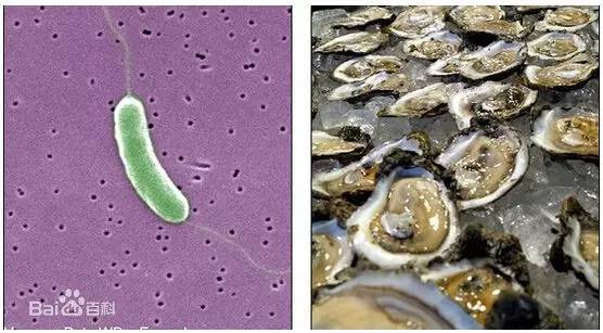 二十四岁小伙吃海鲜丧命原因,小伙生吃海鲜大量出血后续