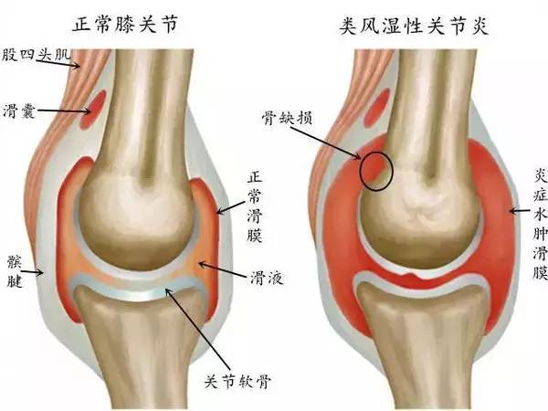 人民医院防控知识宣教活动,市人民医院开展健康科普知识巡讲