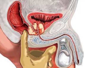 福利连续1个月！佛中医泌尿外科“义诊月”本周5开锣！