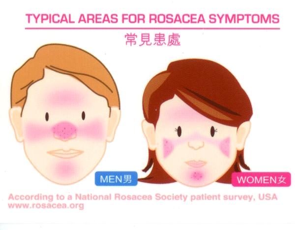 脸上皮肤发红有小红点怎么回事,脸部发红有黄到底是炎症还是敏感