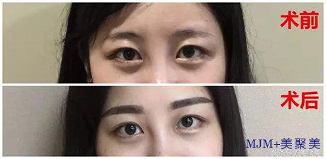 刚做的眉毛又粗又直怎么补救,刚做的眉毛怎么可以颜色淡点