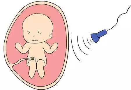 教你轻松看懂孕期b超专用术语,孕妈孕期必须检查的项目