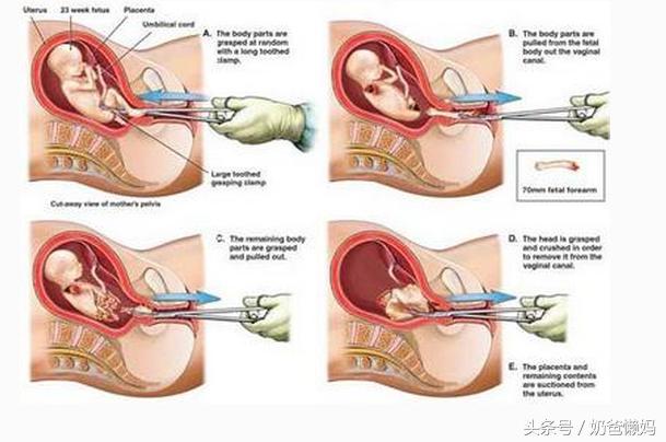 生孩子开几指了意味着什么？那些事你真的明白吗？
