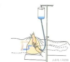 老年人便秘灌肠怎么弄,灌肠便秘怎么办