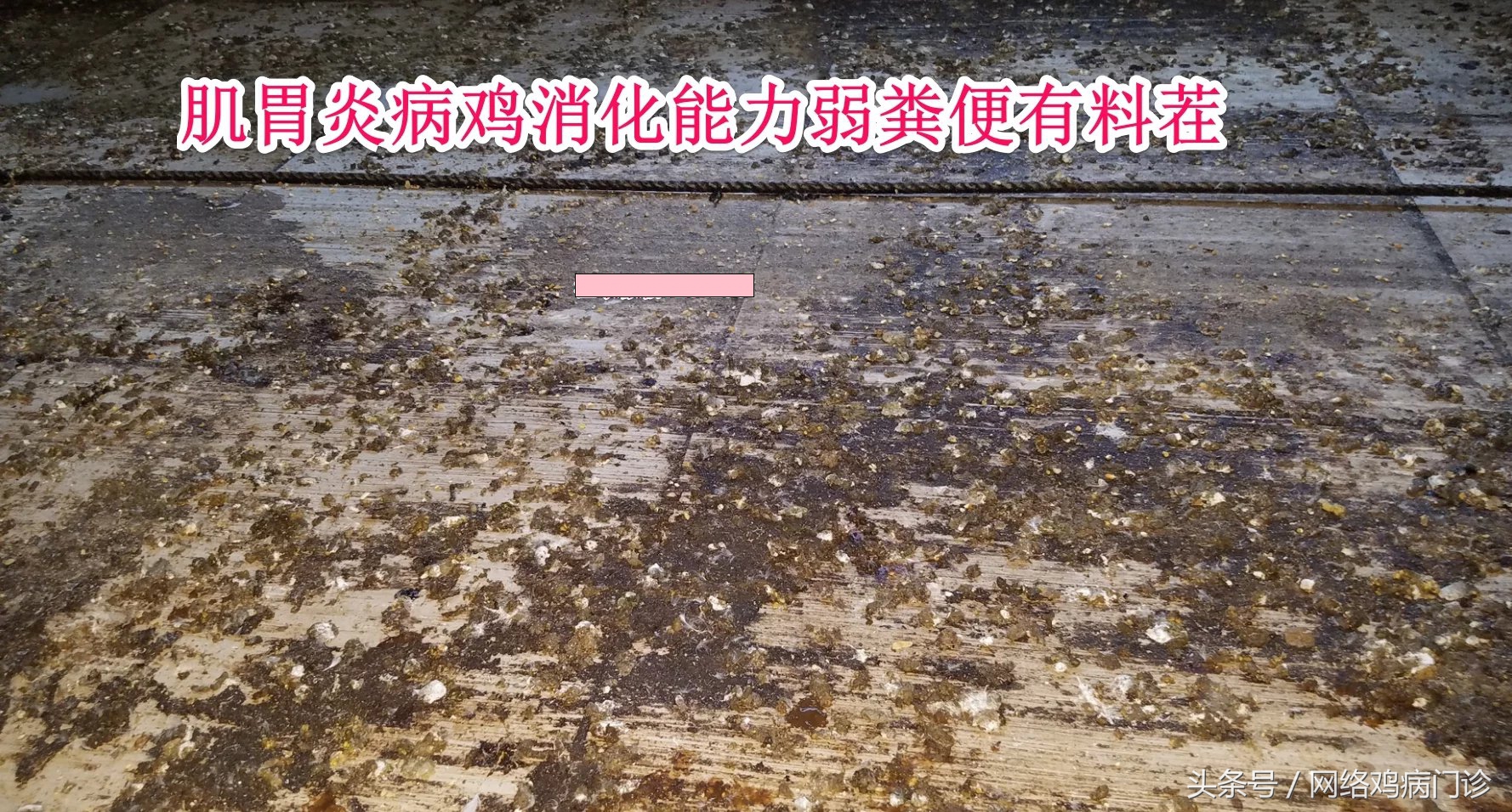 腺肌症治愈的病例分享,鸡腺肌胃炎的治疗成功案例