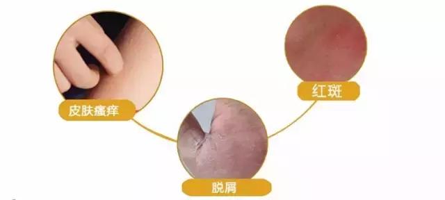 马油面霜到底好不好用,马油面霜的功效