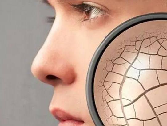 秋冬皮肤干燥如何调理护肤,秋冬干燥肌肤用什么面霜