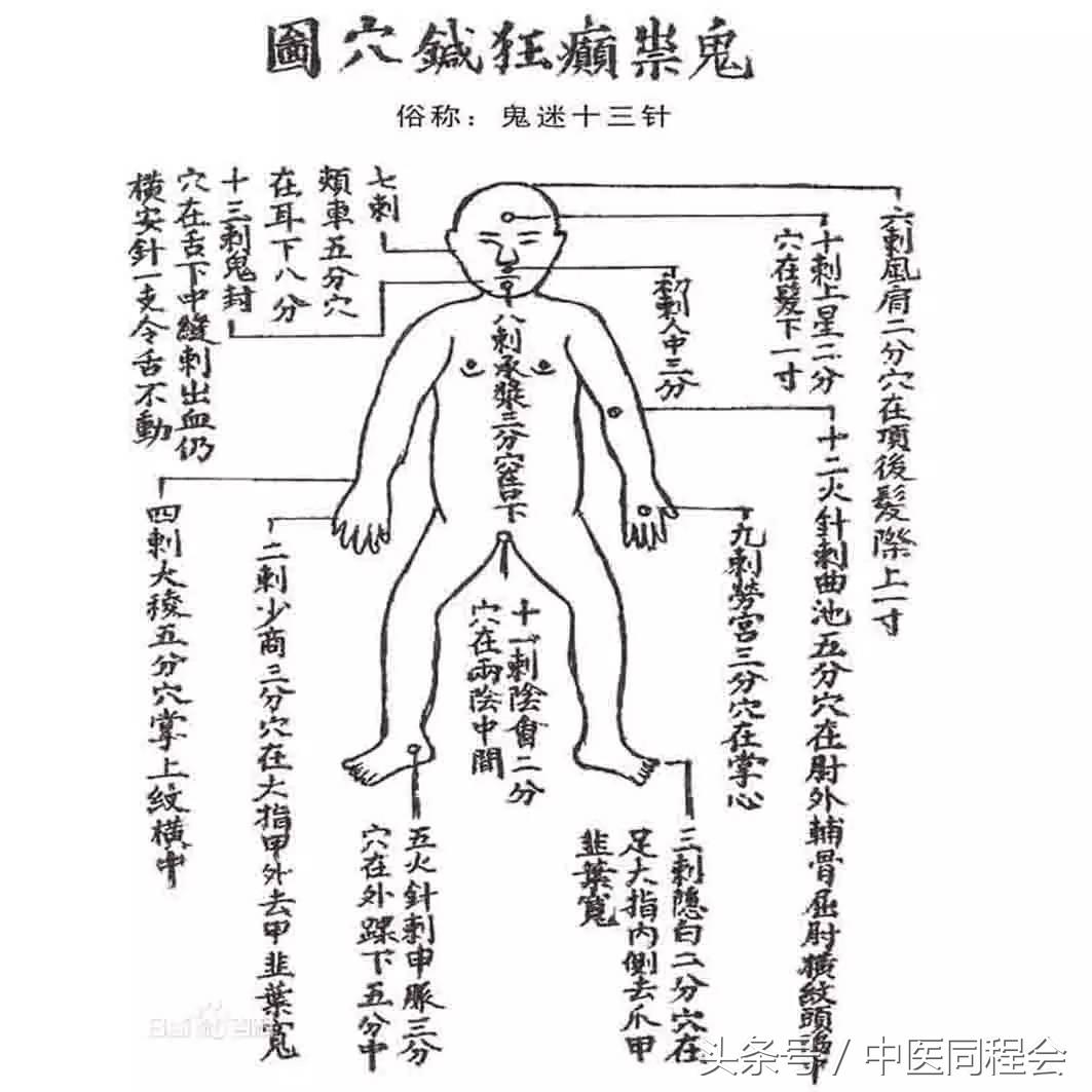 万圣节｜看中医怎么与“鬼”混