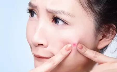 治粉刺*疮痤**毛囊炎“双黄一白散”