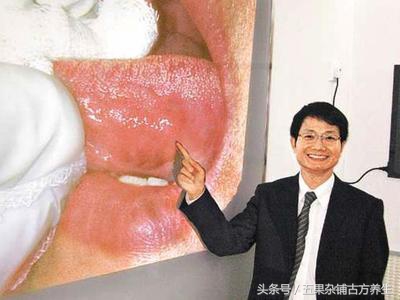 吃槟榔头有点晕是什么反应,为什么吃槟榔脸红发热