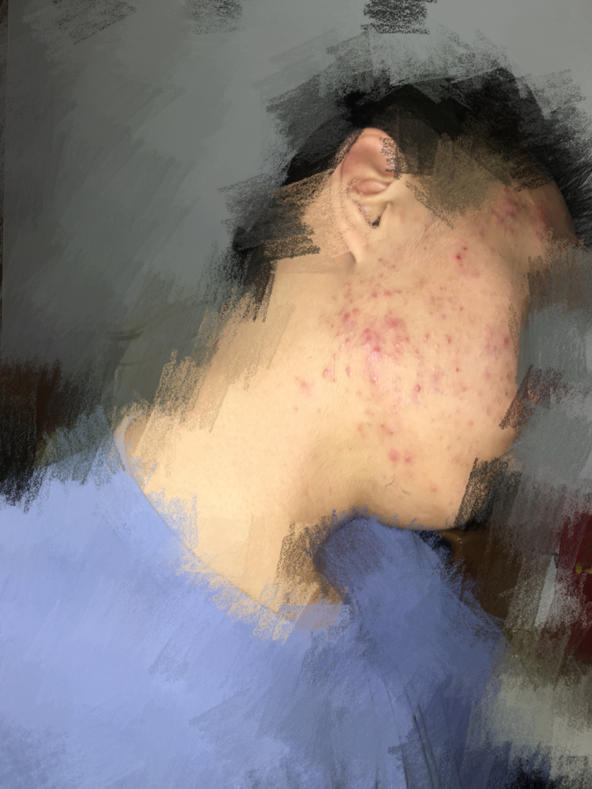 护肤一百问答,女孩健身护肤知识问答