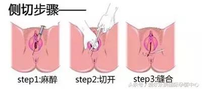 医生可以不拆线吗,医生可以不拔指甲吗