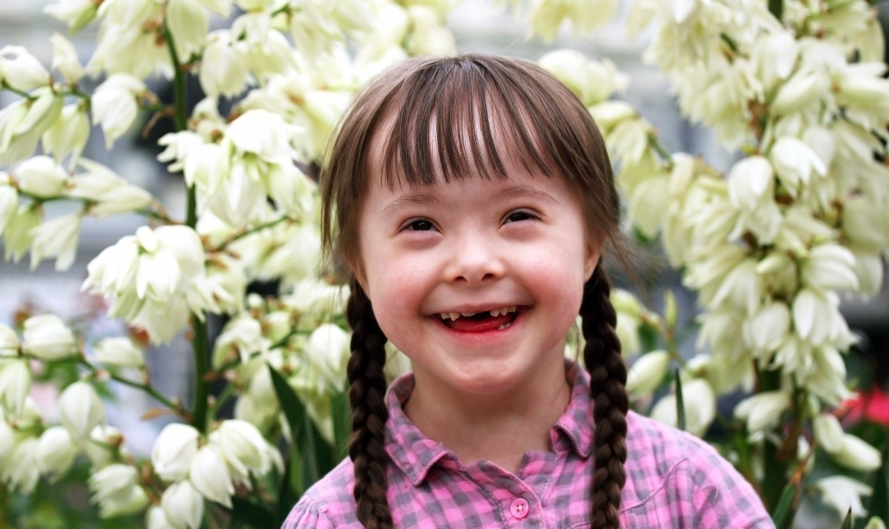 后期发现宝宝是唐氏综合征,唐氏综合征会长胖吗