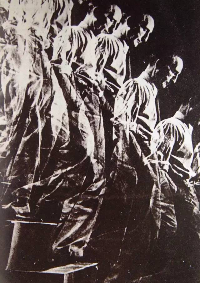 脑外伤会影响智商吗,脑外伤后影响智力吗