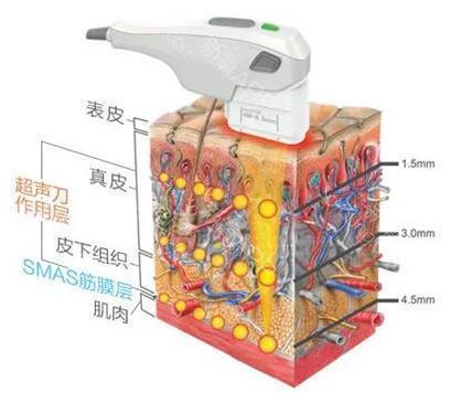 史上最全的超声刀资料与问答，看了都不用请教专家！