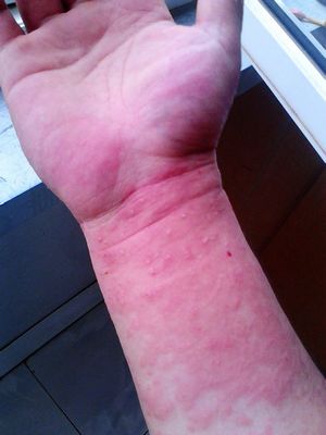 为什么日本人用铝制品,日本大漆餐具对人体有危害吗