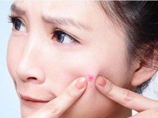 为什么我们喜欢挤痘,挤痘痘到底有多可怕