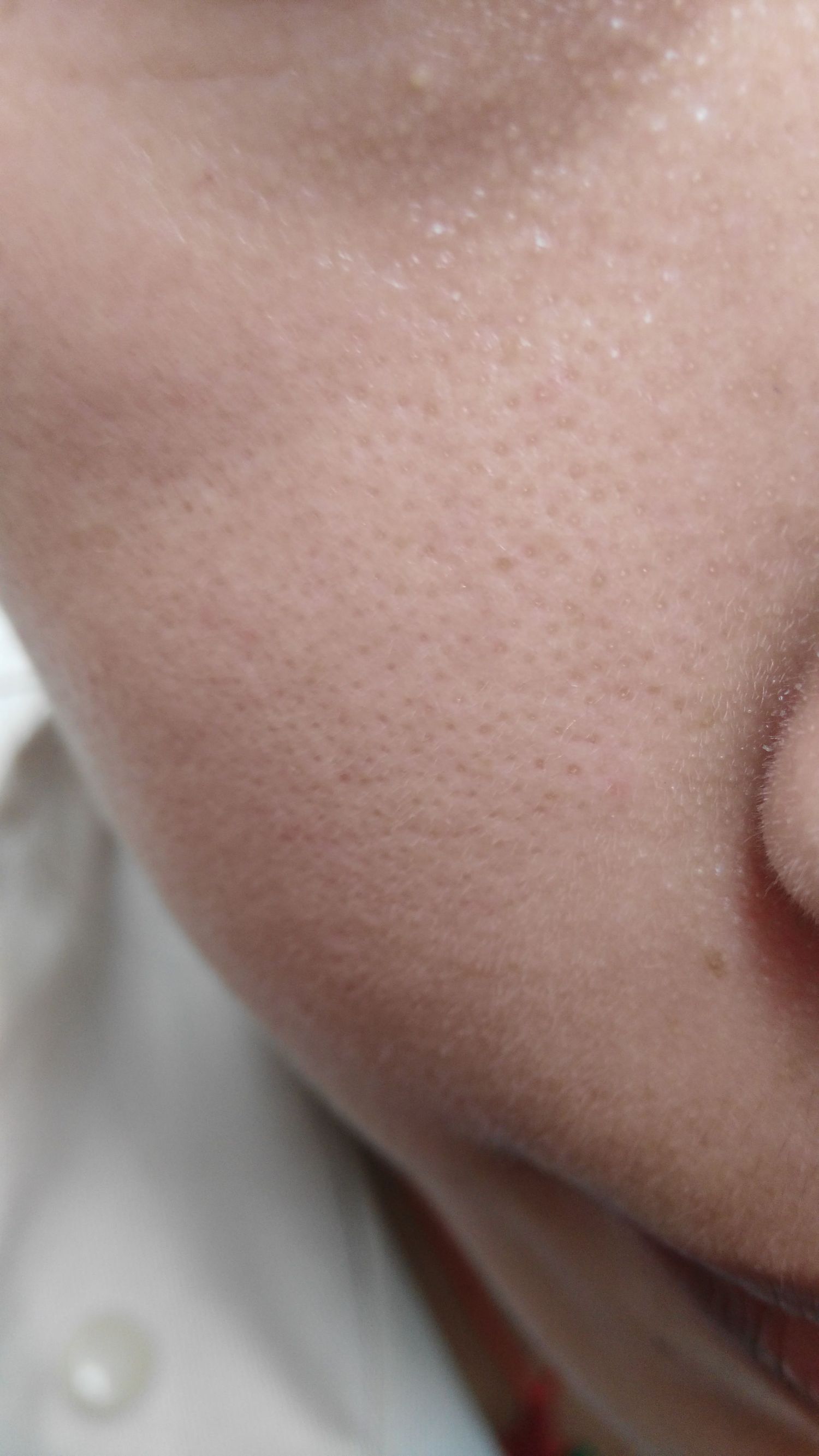 毛孔堵塞怎么办知乎,毛孔堵塞怎么办什么方法最有效