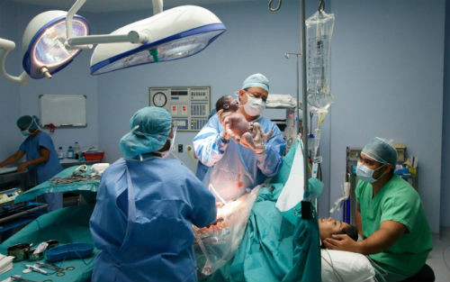 剖宫产宝宝菌群移植,剖宫产菌群