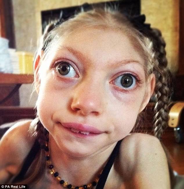 这位妈妈有两个患小头症的女儿，她家的画风是这样的