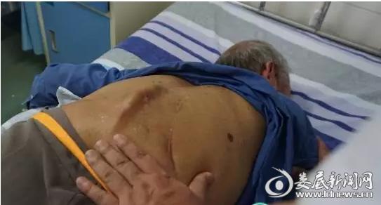 娄星区人民医院精心救治“双肾结石”7旬老人