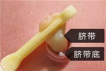 宝宝说明书大全,宝宝脐带科普