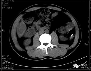 鐥呯悊鍒囩墖闃呯墖澶ц禌,鐥呯悊闃呯墖姣旇禌