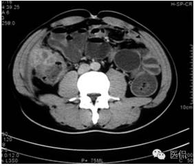 鐥呯悊鍒囩墖闃呯墖澶ц禌,鐥呯悊闃呯墖姣旇禌