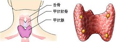 儿童甲状腺肿大会自愈,甲状腺肿大会自己好吗
