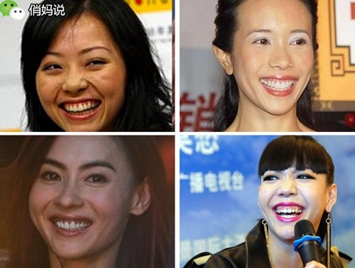 宝宝笑起来露牙龈是什么原因,6岁孩子露牙龈笑最简单改善方法