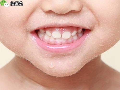 宝宝笑起来露牙龈是什么原因,6岁孩子露牙龈笑最简单改善方法