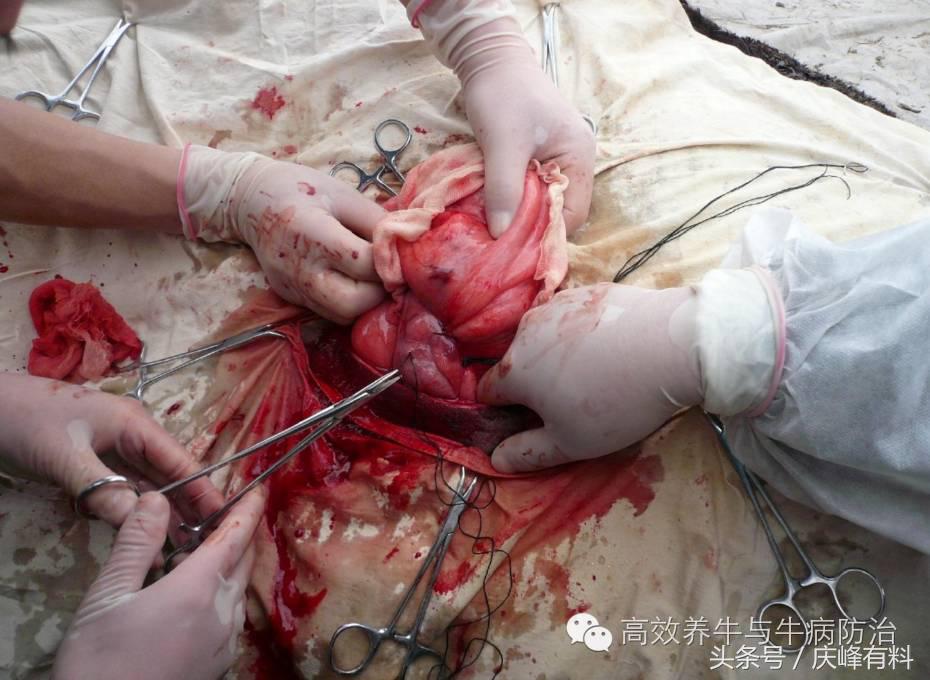 奶牛真胃扩张的症状治疗方法,奶牛皱胃左方变位治疗方法
