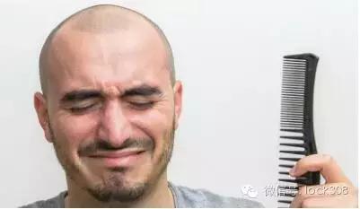 脂溢性脱发头顶脱发严重怎么办,头顶稀疏发缝宽脂溢性脱发怎么办