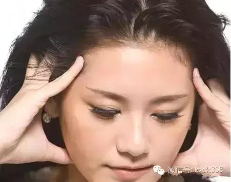 脂溢性脱发头顶脱发严重怎么办,头顶稀疏发缝宽脂溢性脱发怎么办