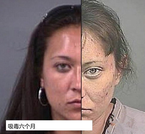 慎点！吸食*毒冰**后脸变形（组图）