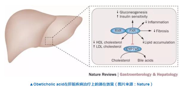 奥贝胆酸主治什么病,奥贝胆酸对胆汁反流有效吗