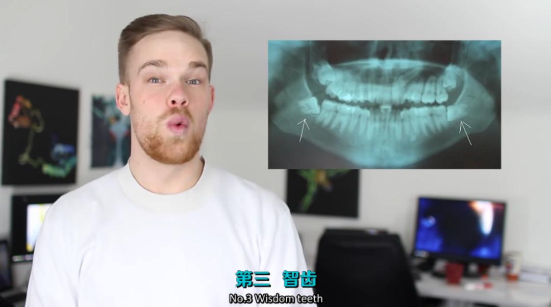 你身上哪些器官属于五官,你身上有哪些部位不能碰