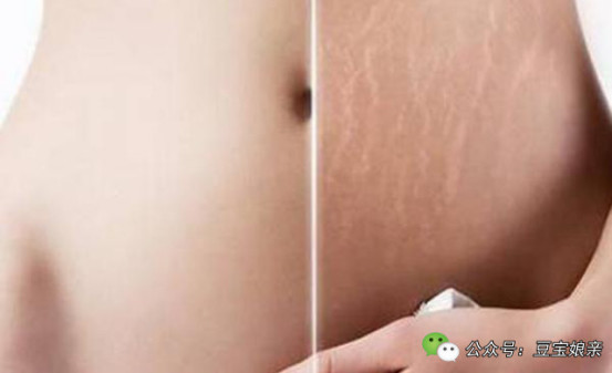 产后宝妈改变体质最佳机会,都说生完孩子后显老