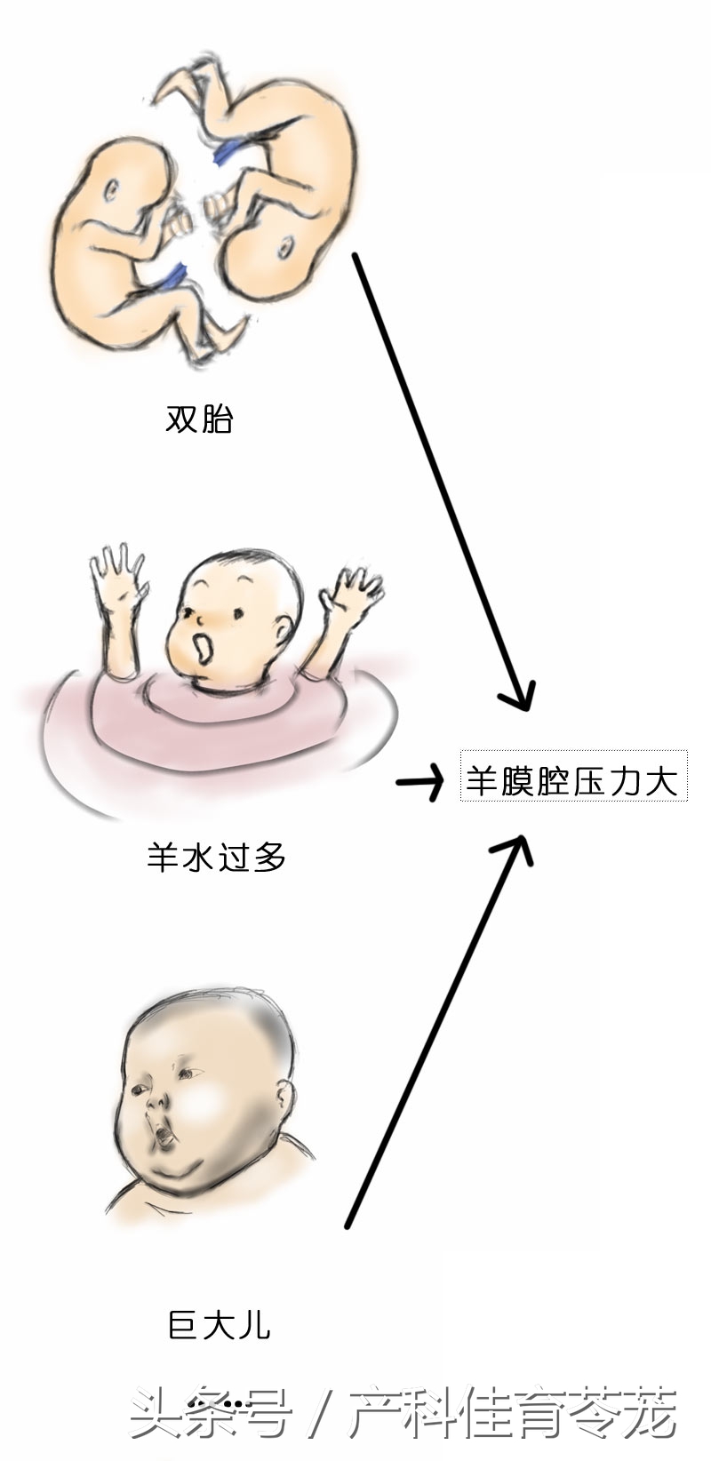 破水了，害怕吗？产科医生教您这样应对