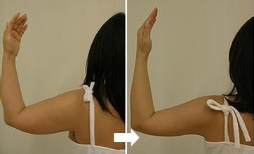 怎么快速瘦胳膊最快方法,甩胳膊能瘦胳膊吗