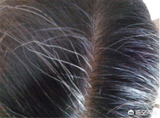 怀孕不能染发有白头发怎么办,怀孕后为什么会长白头发