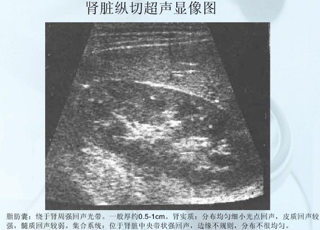 b超肾脏正常肾脏就没问题吗,做一次肾脏的检查