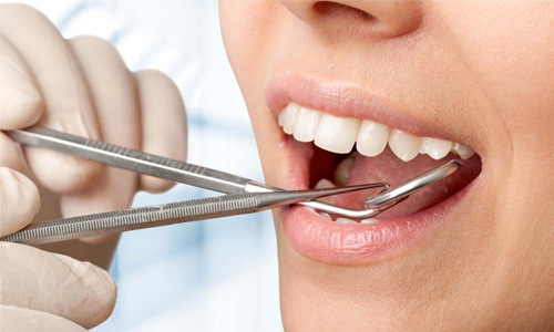 老长着口疮应该吃点什么好,老起口疮挂什么科