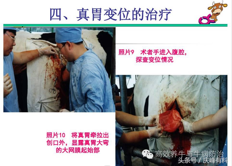 奶牛真胃扩张的症状治疗方法,奶牛皱胃左方变位治疗方法