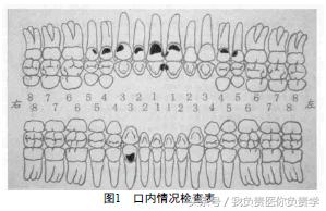 口腔疾病防治的方法,口腔龋病