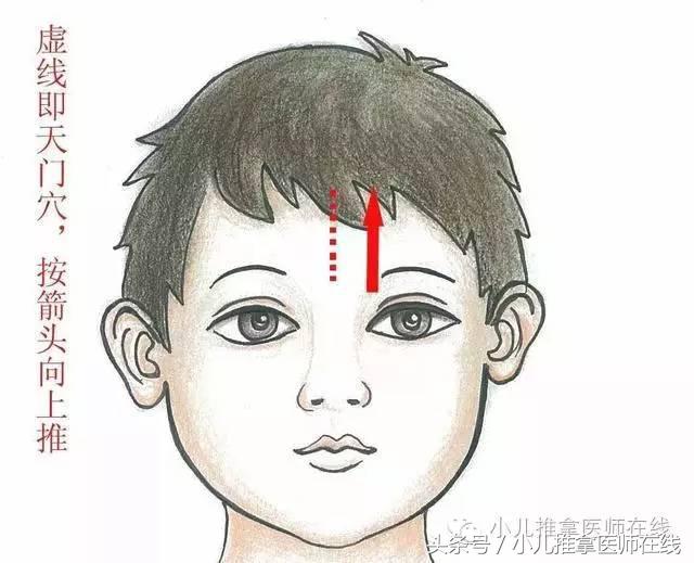 小儿推拿治鼻炎最好的方法,小儿过敏性鼻炎的推拿和艾灸