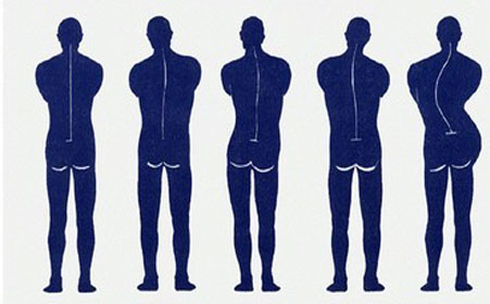 强直性脊柱炎呈竹节状恢复训练,强直性脊柱炎的中医治疗原则