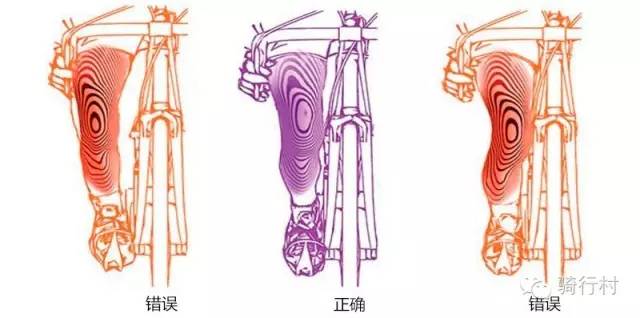骑行膝盖内侧疼痛,骑行可以治疗膝盖疼痛吗