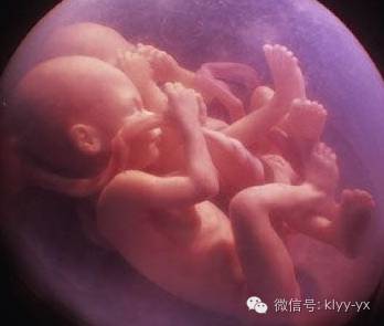 分娩见红为什么还没开宫口,临产前见红一定是分娩前兆吗